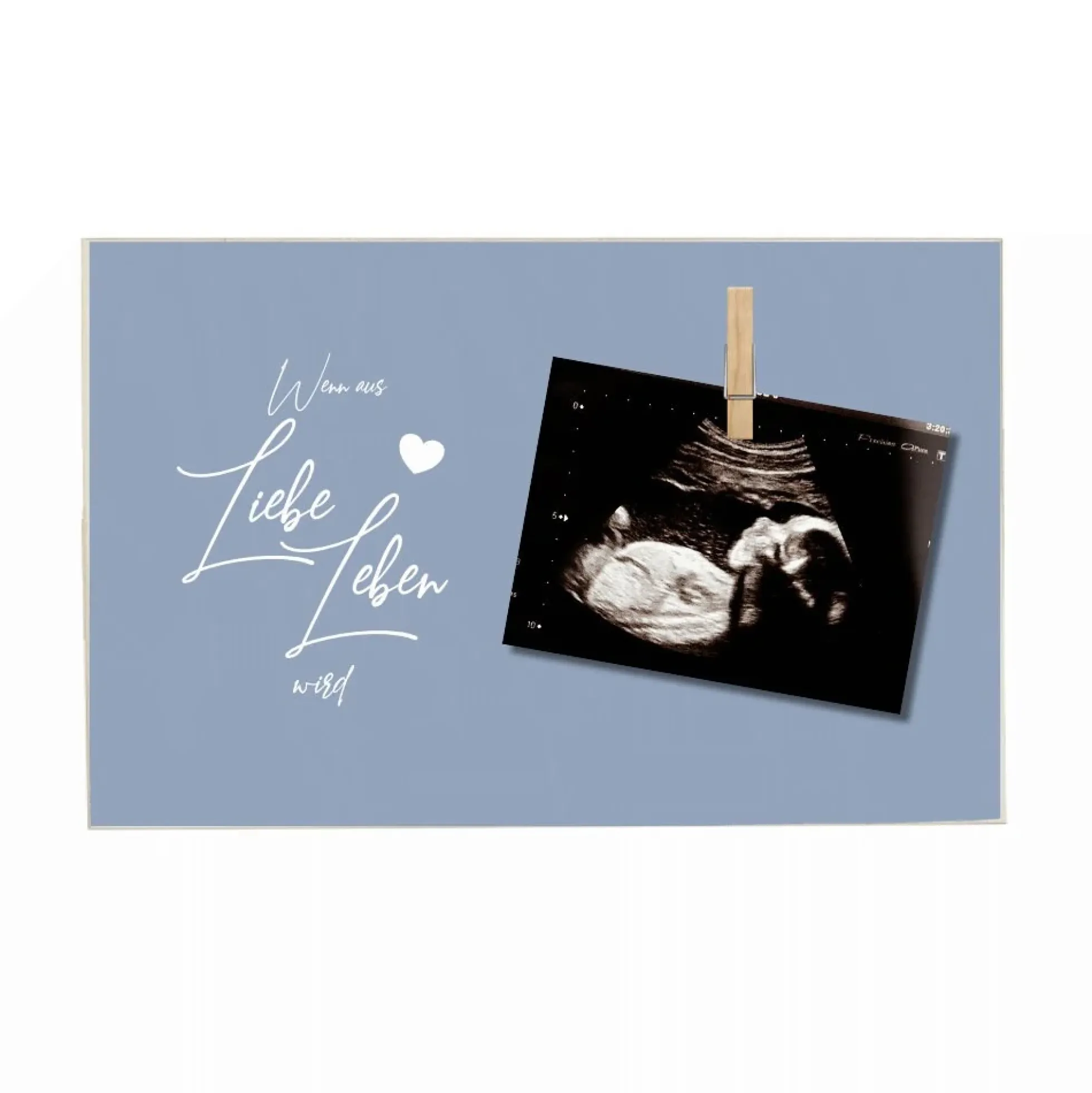 Tolles Fotogeschenk aus Holz für werdende Eltern | Holzbild mit Spruch "Wenn aus Liebe Leben wird“ | Memoboard mit Holzklammer zum selbstständigen Befestigen eines Fotos oder des Ultraschallbildes | 3 Farbvarianten zur Auswahl